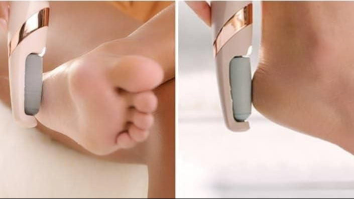 SkinSpin Pro – Cordless Electronic Pedicure Tool